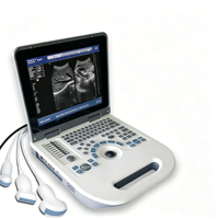 Système de diagnostic vétérinaire portable médical, scanner HD 12 pouces, appareil d'échographie automatique pour animaux