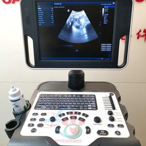 Ecógrafo Doppler Color Mindray DC-28 Usado, Máquina de Ultrasonido Portátil - Product Image 6