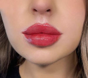 Approvisionnement exclusif Hadurage 2*1ml Lip Filler - Gel HA monophasique pour des contours de lèvres rouges lisses, résultats rouges naturels, <span class=keywords><strong>prix</strong></span> en gros - Product Image 2