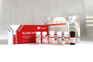 Solarbio Chất lượng cao Chuột dickkopf liên quan đến protein 1 dkk1 Elisa Kit cho nghiên cứu khoa học - Product Image 3