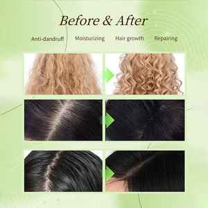 <span class=keywords><strong>Ba</strong></span> SEED น้ำมันบำรุงทุกวันแชมพูน้ำมันต้นชาป้องกันรังแคซ่อมแซมลึกสำหรับปลูกผมป้องกันการสูญเสีย2-in-<span class=keywords><strong>1</strong></span>ฟรี - Product Image 2