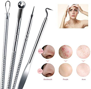 Juego de 4 Herramientas para Extraer Puntos Negros, Agujas de Acero Inoxidable para Eliminar el Acné - Product Image 4