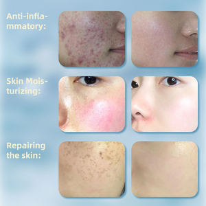 Crema Blanqueadora con Ácido Tranexámico y Vitamina C <span class=keywords><strong>de</strong></span> Nuestra Propia Marca, <span class=keywords><strong>para</strong></span> la Pigmentación, Manchas Oscuras, Acné y Piel Sensible, <span class=keywords><strong>para</strong></span> Todo Tipo <span class=keywords><strong>de</strong></span> Piel - Product Image 2