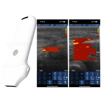 Sonde d'échographie portable sans fil 20 Hz à 192 éléments pour soins esthétiques de la peau