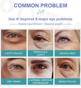 Mirco cream 60s Fast Effect Instant reduziert Falten Augen taschen Lifting Magic Eye Cream - Product Image 3