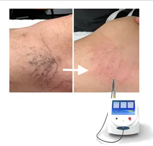 Máquina vascular de remoção de veias aranha 980 1470 para vasos sanguíneos, máquina de remoção a laser, endoplasma, levantamento facial, laser