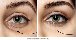 Patchs sous les yeux en silicone réutilisables de marque privée avec étui de rangement pour les soins quotidiens de la peau et les extensions de cils - Product Image 3