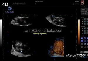 LANNX uRason CX30 Hot Style Hospital Ultrasonido Máquina PW/CFM Ecocardiografía para OB GYN Color Doppler USG Escáner
