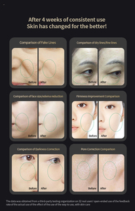 Meilleures ventes de l'année : Appareils de beauté à domicile pour revitaliser le collagène, raffermir et éclaircir la peau, avec contrôle précis et plus sûr de la température - Product Image 6