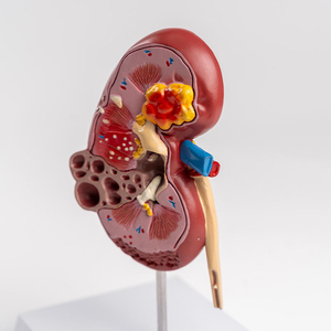 Modelo Anatómico de Riñón Humano de PVC, Lesión Renal para la Enseñanza de Ciencias Médicas - Product Image 1