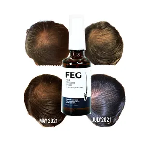 Migliora la crescita dei capelli olio di zenzero per la crescita dei capelli prodotti per la cura naturale OEM