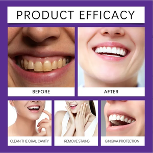 Limpia y protege suavemente <span class=keywords><strong>los</strong></span> <span class=keywords><strong>dientes</strong></span> para una frescura duradera y elimina las manchas y <span class=keywords><strong>los</strong></span> <span class=keywords><strong>dientes</strong></span> amarillos Polvo de belleza púrpura - Product Image 5