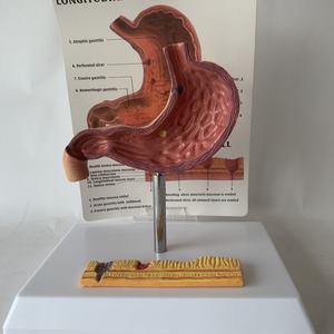 Медицинские науки небольшой размер патологии человека анатомическая модель желудка модели анатомических органов человека - Product Image 5