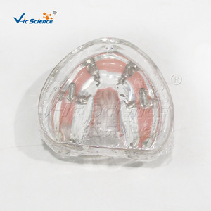 Modèle de Restauration d'Implant Maxillaire M6001-1, Structure de Prothèse Dentaire Démontable, Aide Pédagogique pour la Formation Dentaire - Product Image 3