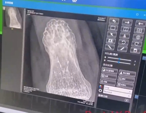 Kỹ thuật số di động nha khoa x Ray máy ảnh không dây di động X-Ray máy ảnh với X-Ray cảm biến - Product Image 3