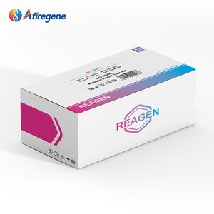 도매 바이러스 신속 검출 조류 인플루엔자 바이러스 H5N1 항원 검사 키트 (우유 검사용) - Product Image 1