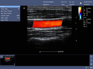 Appareil d'échographie Doppler couleur portable N20 de qualité supérieure pour cliniques vétérinaires, avec écran LED haute définition - Product Image 5