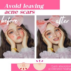 Mới đến long lanh mụn vá bướm hình dạng Blemish vá Hydrocolloid tì vết dán long lanh mụn vá - Product Image 5