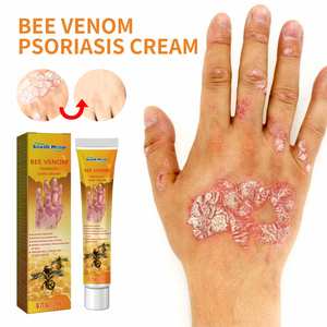 Krim <span class=keywords><strong>Psoriasis</strong></span>, krim kulit infeksi jamur 20G salep Dermatitis Eczema perawatan <span class=keywords><strong>Psoriasis</strong></span> - Product Image 4