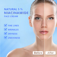 Crème pour le visage à la niacinamide pour les soins de la peau de marque privée dissolvant de points noirs au rétinol crème pour le visage blanchissante à la vitamine C avec logo personnalisé