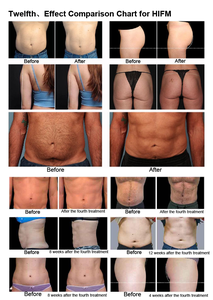 Équipement de beauté 2 en 1 pour le renforcement des cellules graisseuses et du métabolisme à grande vitesse, renforcement musculaire, soin du visage et du corps, gain de masse musculaire et perte de graisse - Product Image 5