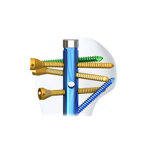 Chuyên Nghiệp Y Tế Chỉnh Hình Cấy Ghép Multiloc Humeral Lồng Vào Nhau Móng Tay 3.5 Khóa Vít - Product Image 4