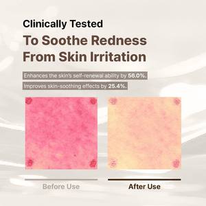 Oem Huidverzorging Bestseller Verhelderende Peptidecrème Voor Rustgevende, Hoge Vocht Pdrn Revitaliserende Crème Maatwerk. - Product Image 3