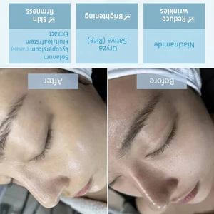 Suero Facial Antienvejecimiento con Niacinamida para Mujeres, Ampolla de Cultivo de Células Madre para Microagujas, Reduce los Poros, Ilumina y Revitaliza - Product Image 4