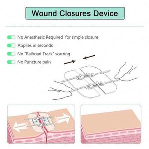 Non-Latex Hemostatic Drainage Bag Leg <b>Binding</b> Strap Adhesive <b>Tape</b> - Product Image 3