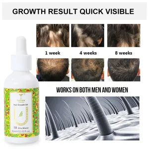 Stok mevcut rekabetçi fiyat organik biberiye nane derisi teşvik saç büyüme serum biyotin güçlendirilmesi yağ