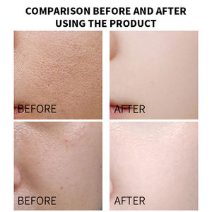 Set de Cuidado de la Piel Natural de Marca Privada, Crema de Aloe Vera Blanqueadora y Reparadora - Product Image 6