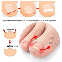 Autocollant pour ongles en U, élastique, anti-roulement, avec coussinet orthopédique ajustable pour la rainure de l'ongle, patch extensible pour ongles incarnés