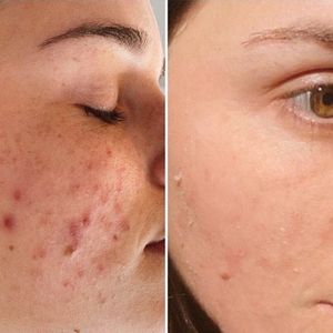 Mascarilla facial <span class=keywords><strong>de</strong></span> <span class=keywords><strong>algas</strong></span> marinas orgánicas OEM al por mayor mascarilla <span class=keywords><strong>de</strong></span> limpieza <span class=keywords><strong>de</strong></span> piel seca hidratante efecto <span class=keywords><strong>Peeling</strong></span> hidratante - Product Image 3