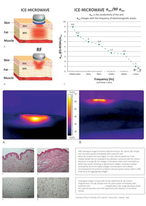 Máquina de Reducción de Grasa y Escultura Corporal Vertical Onda Pro CoolWave FreezeWave de 2.45GHz - Product Image 3