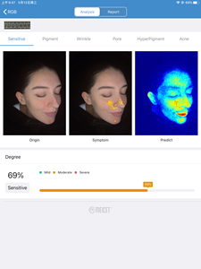 Intelligent Digital AI Beauty Magic Mirror Wood Lamp MC88 Facial Skin <span class=keywords><strong>Analyser</strong></span> Prediction <span class=keywords><strong>Equipment</strong></span> for Face for US JP ZA Plugs - Product Image 3