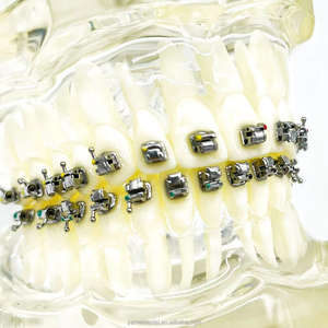 Produk gigi braket ortodontik Plus 5 seri braket torsi tinggi kotak plastik CE ortodontik penjepit 3 tahun Set kawat gigi <span class=keywords><strong>Kit</strong></span> - Product Image 3