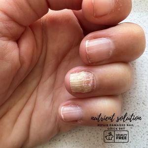 <span class=keywords><strong>El</strong></span> <span class=keywords><strong>mejor</strong></span> suero reparador <span class=keywords><strong>de</strong></span> <span class=keywords><strong>hongos</strong></span> <span class=keywords><strong>para</strong></span> <span class=keywords><strong>uñas</strong></span>, botella <span class=keywords><strong>de</strong></span> vidrio <span class=keywords><strong>de</strong></span> 15ml, suero <span class=keywords><strong>para</strong></span> crecimiento <span class=keywords><strong>de</strong></span> pies y <span class=keywords><strong>uñas</strong></span>, <span class=keywords><strong>tratamiento</strong></span> fúngico - Product Image 6