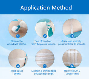 เทปปิดแผลแบบไม่ต้องเย็บ Steri-Strip สำหรับหลังคลอดและหลังผ่าตัด ใช้สำหรับปิดแผล - Product Image 5