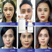 Masque Visage OEM en V Effet Lifting, Produits Anti-Âge Hydratants, Masque Facial Lissant Anti-Rides, Soin Hydratant pour une Peau Lisse