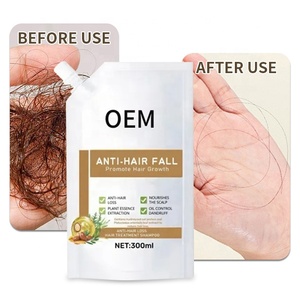 Shampooing <span class=keywords><strong>anti</strong></span>-chute à base de plantes bio vegan pour le traitement de la <span class=keywords><strong>calvitie</strong></span> prévenir la perte de cheveux favoriser la repousse des cheveux shampooing vente en gros - Product Image 2