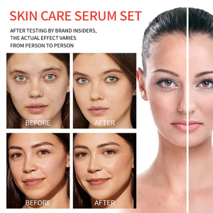 Siero Viso e Corpo all'Ingrosso 300ml con Vitamina <span class=keywords><strong>C</strong></span>, Glutatione, <span class=keywords><strong>Papaya</strong></span>, Acido Kojico, AHA, Curcuma e Alfa Arbutina - Product Image 6