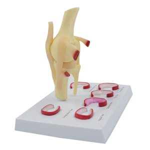 Modèle anatomique de l'articulation du genou avec ménisque pour l'enseignement médical, les études <span class=keywords><strong>cliniques</strong></span> et la communication médecin-patient avec CE - Product Image 3