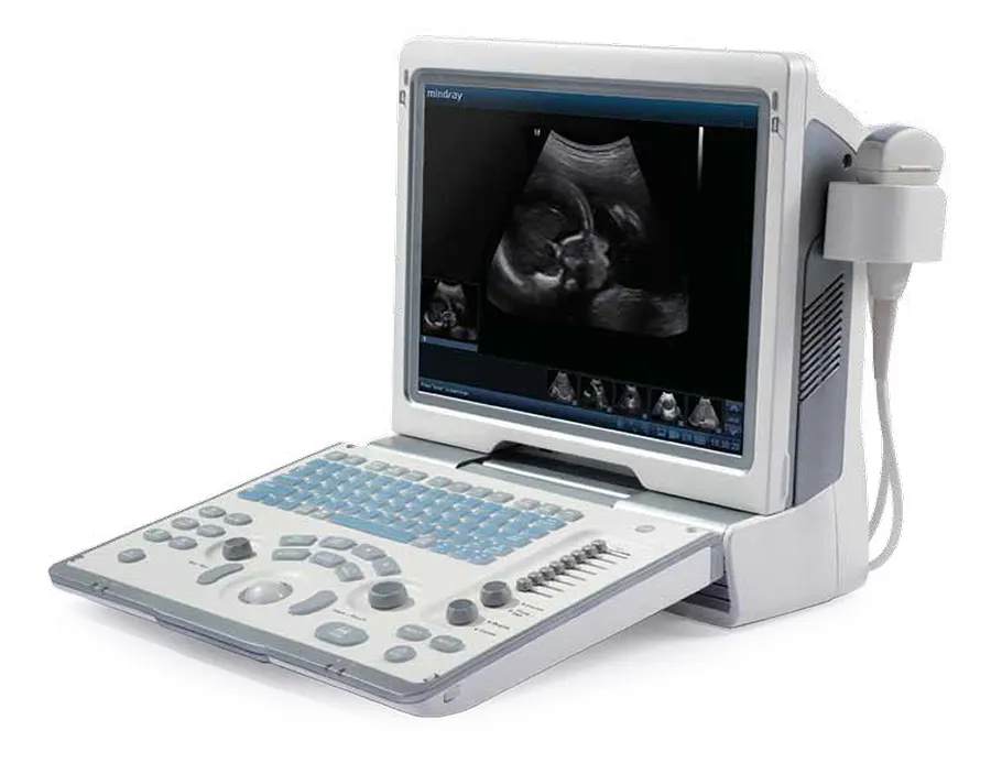 Macchina di ultrasuono di Mindray DP-50 sistema di Imaging diagnostico ultrasonico di Digital