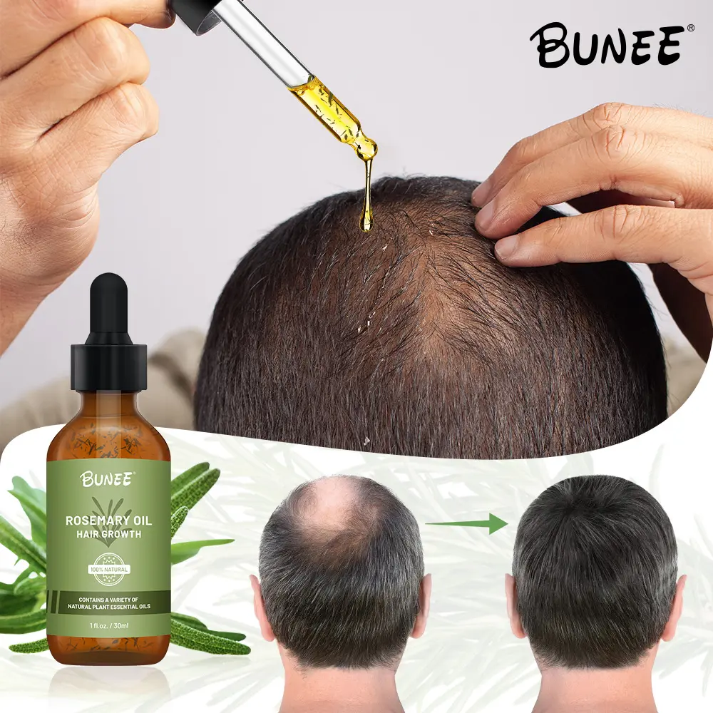 El mejor precio Vegan Organics Romero Menta Cuero cabelludo Fortalecimiento del cabello Nutre el cuidado del cabello aceite para el crecimiento del cabello