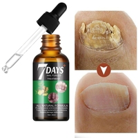 Sérum Anti-Champignons Ongles en 7 Jours Répare les Ongles et Cuticules Endommagés Traitement des Mycoses 30ml MOOYAM