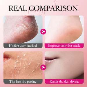 OEM SADOER protezione idratante all'ingrosso idratante mano squalano bastone pesca Anti Cracking balsamo <span class=keywords><strong>per</strong></span> la cura della pelle <span class=keywords><strong>crema</strong></span> <span class=keywords><strong>per</strong></span> i <span class=keywords><strong>piedi</strong></span> - Product Image 5