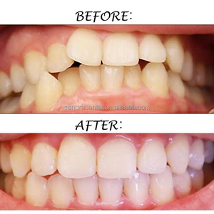 Hot Items Orthodontic Standard MBT 018 Brackets Dental Machinery Power Source - Product Image 6