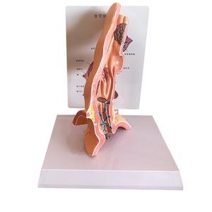 Modelo Anatómico de Enfermedad Patológica del Esófago KyrenMed, Modelo de Polipo Esofágico con <span class=keywords><strong>Erosión</strong></span>, Ampliado 5 Veces - Product Image 2