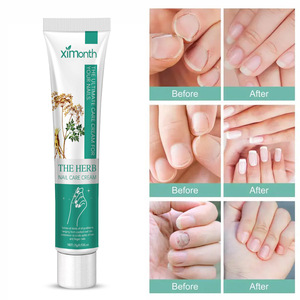 Vente en gros Ximonth Herbal Traitement de la décoloration Crème de soin des ongles Réparation des fissures Crème antifongique - Product Image 2