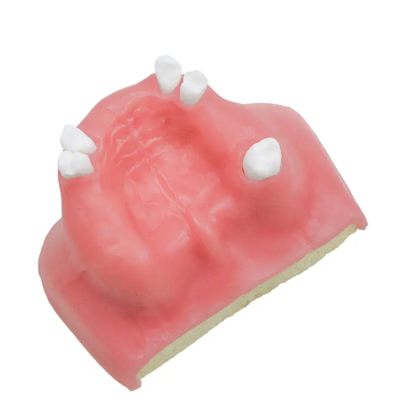 歯科用歯モデル上顎静脈インプラント練習カスタマイズされた歯教育リソース用モデル